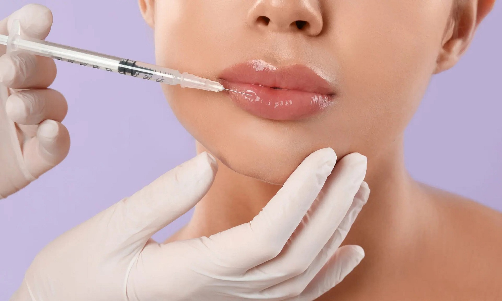 Lip Filler